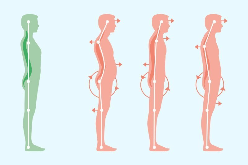 Correct standing posture