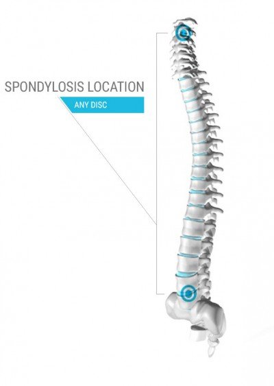 Spine diagram